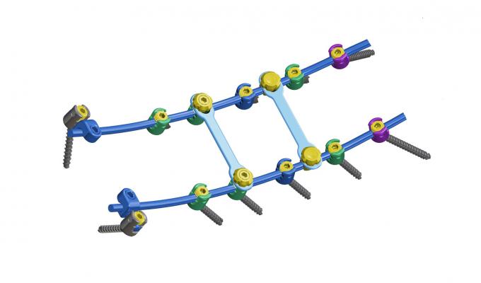 脊柱內(nèi)固定器 釘棒系統(tǒng)