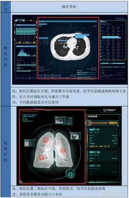 肺結(jié)節(jié)CT影像輔助檢測軟件Yitu_AICare_CT_Chest