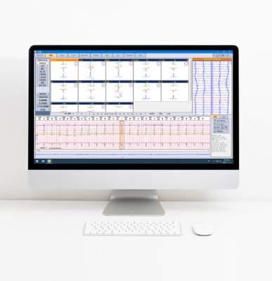 動(dòng)態(tài)心電圖分析系統(tǒng)jrt-y