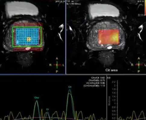 前列腺mri醫(yī)學(xué)影像存儲(chǔ)傳輸與處理軟件
